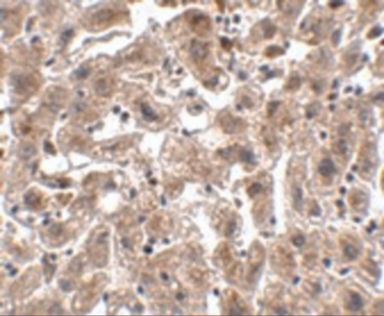 Immunohistochemistry of OCLN in human liver tissue with OCLN antibody at 2.5 ug/mL.
