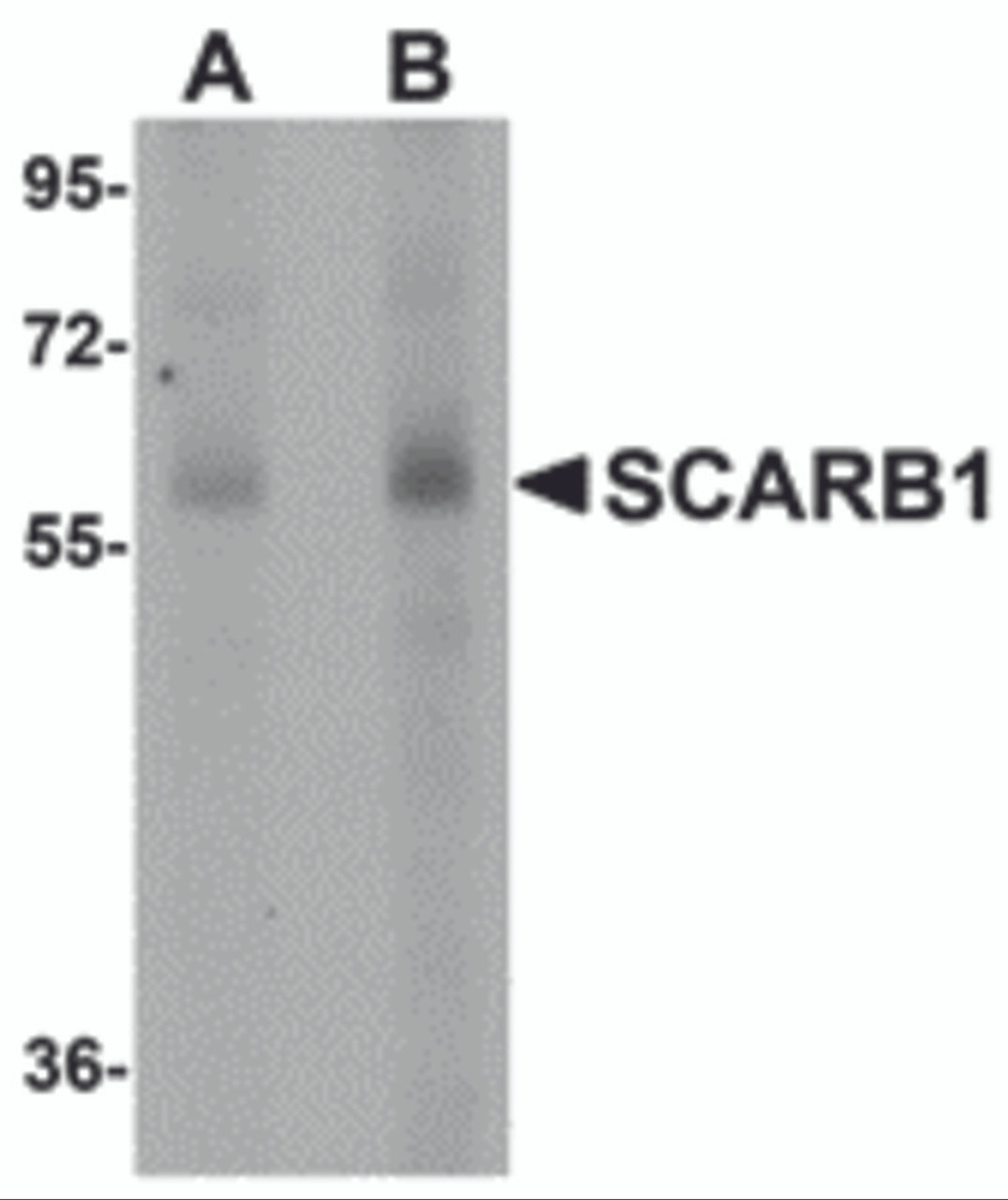 Western blot analysis of SCARB1 in human spleen tissue lysate with SCARB1 antibody at (A) 1 and (B) 2 &#956;g/mL.