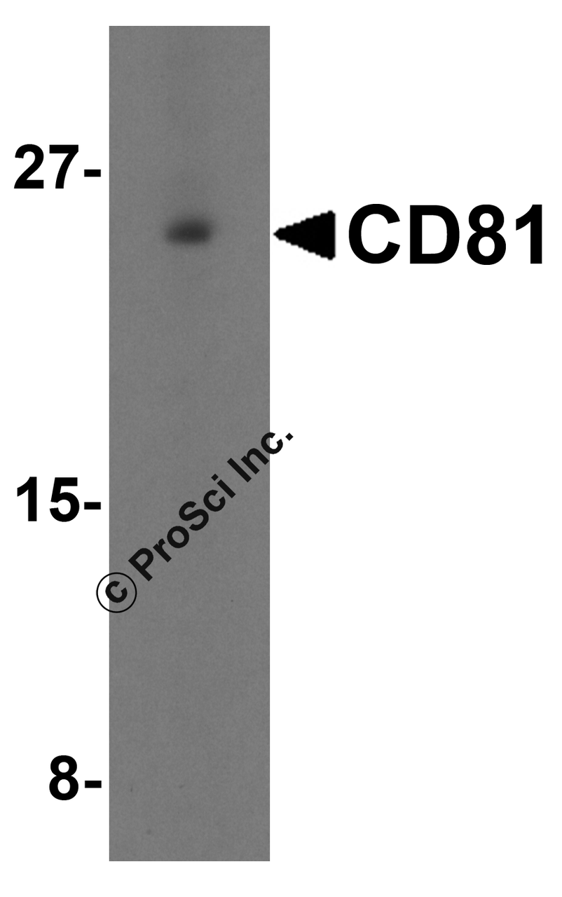 Western blot analysis of CD81 in human lung tissue lysate with CD81 antibody at 1 &#956;g/mL in (A) the absence and (B) the presence of blocking petide.