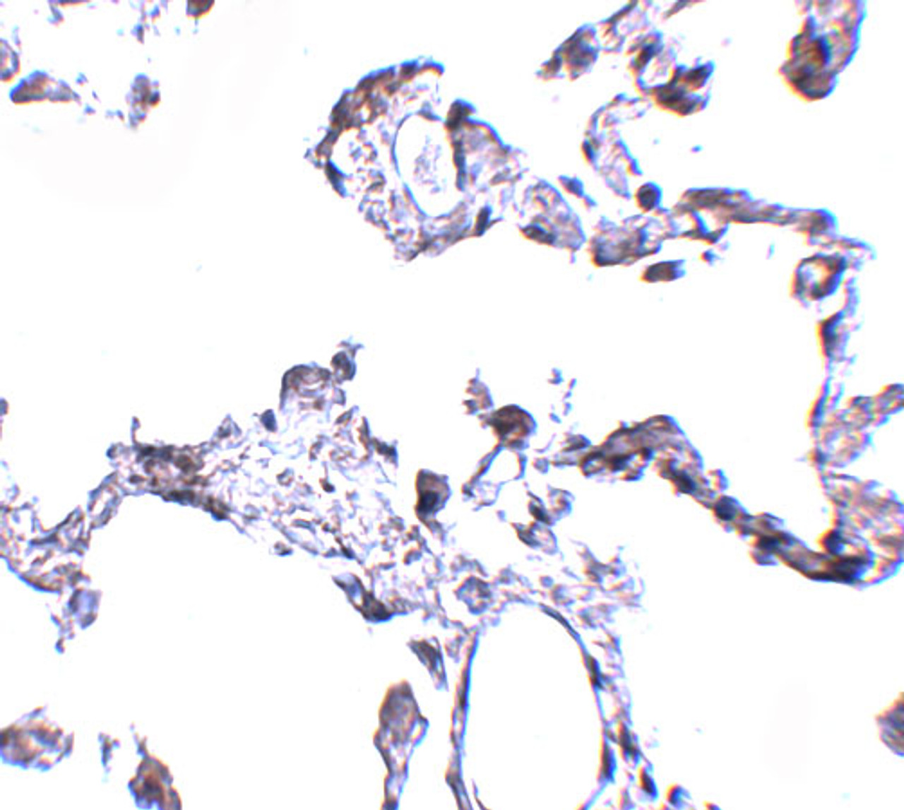 Immunohistochemistry of CD81 in human lung tissue with CD81 antibody at 5 ug/mL.