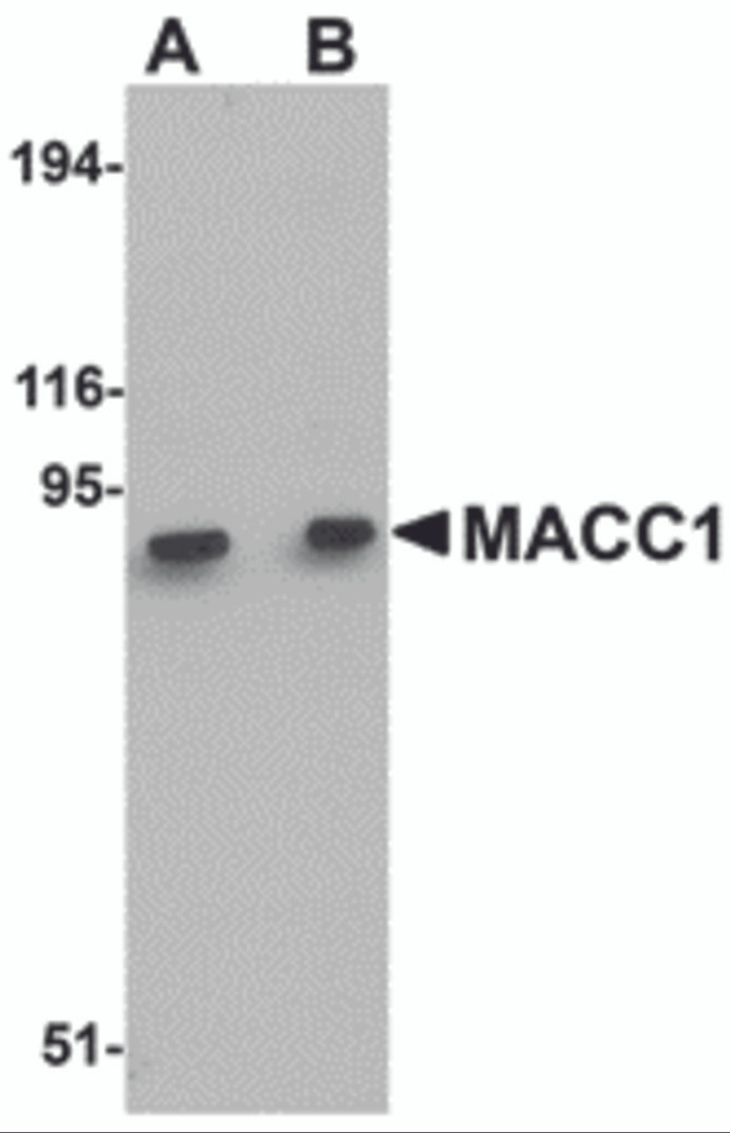 Western blot analysis of MACC1 in mouse liver tissue lysate with MACC1 antibody at (A) 1 and (B) 2 &#956;g/mL.