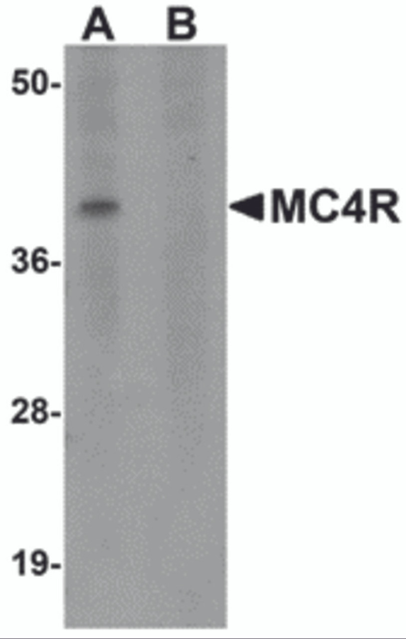 Western blot analysis of MC4R in rat brain tissue lysate with MC4R antibody at 1 &#956;g/mL in (A) the absence and (B) the presence of blocking peptide.