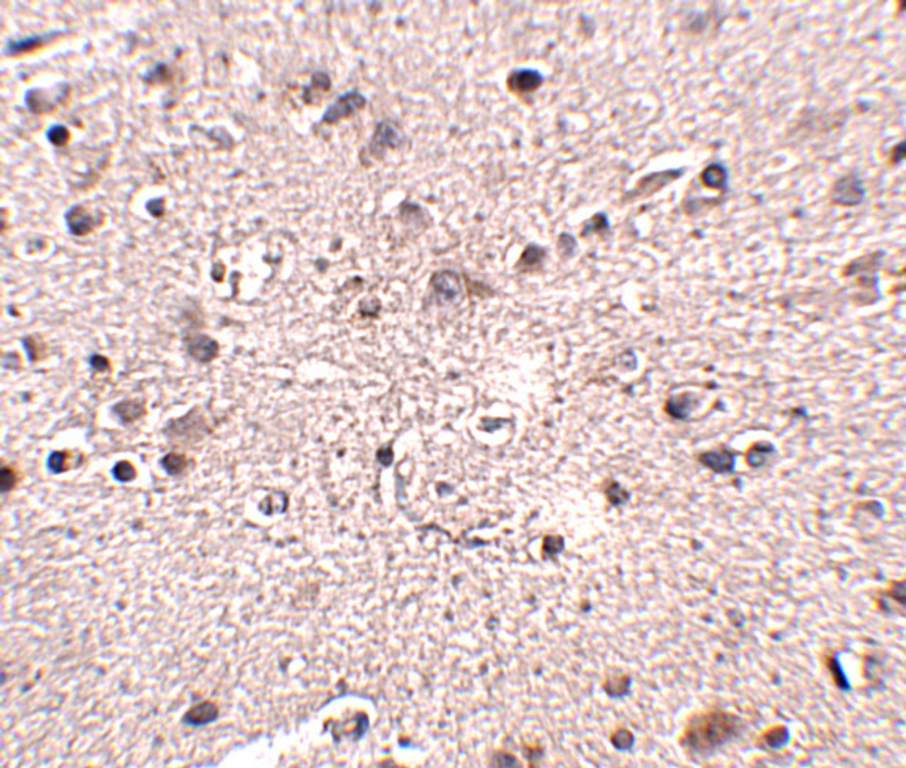 Immunohistochemistry of MC4R in human brain tissue with MC4R antibody at 2.5 ug/mL.