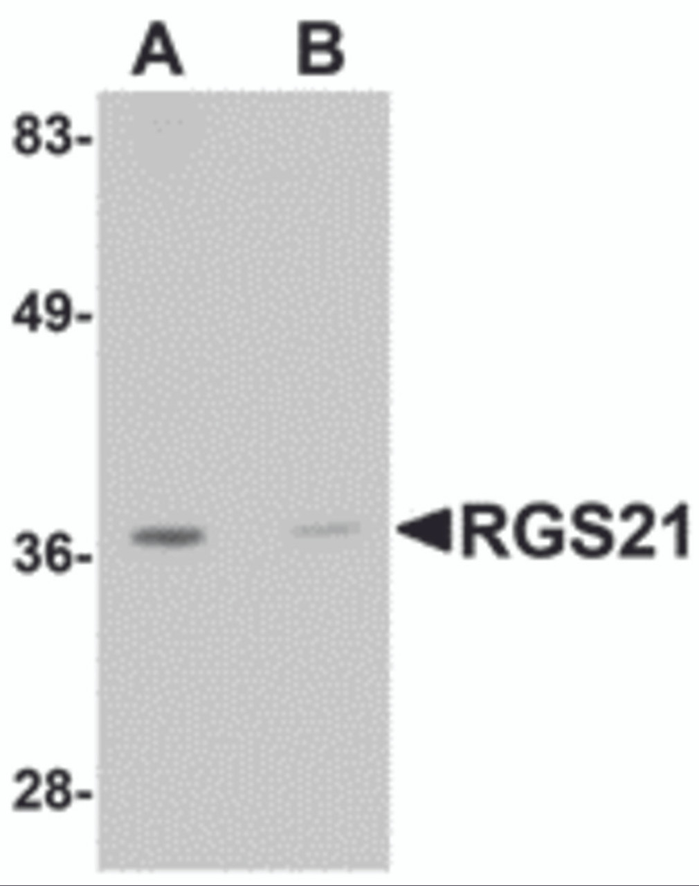 Western blot analysis of RGS21 in HepG2 cell lysate with RGS21 antibody at 0.5 &#956;g/mL in (A) the absence and (B) the presence of blocking peptide.
