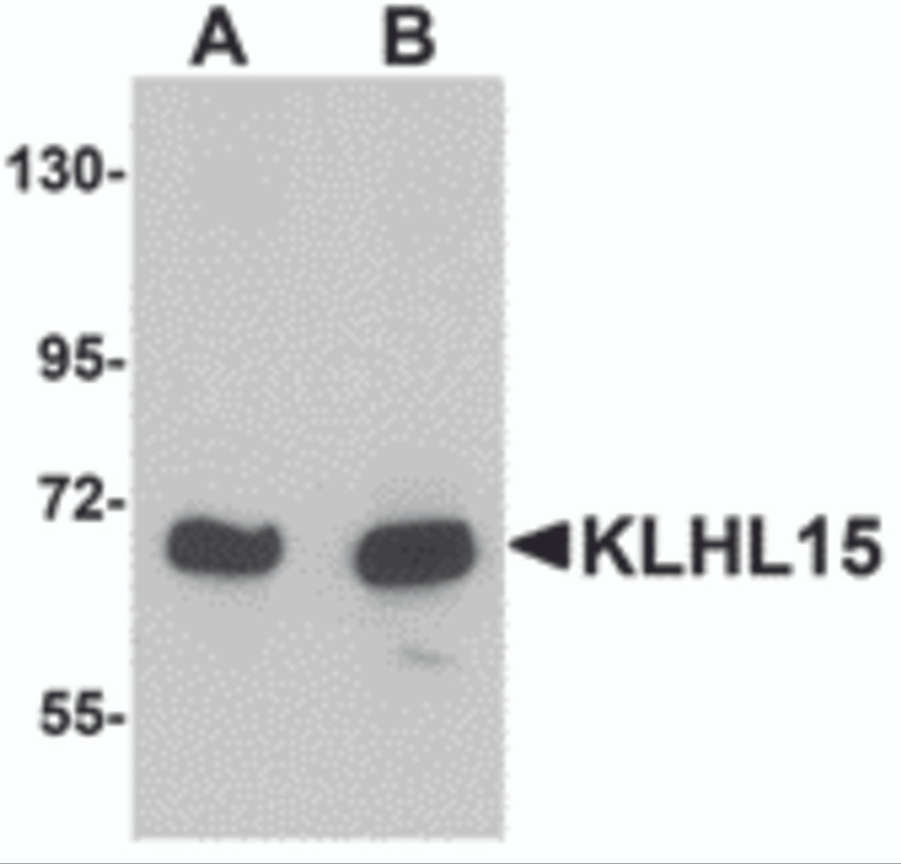 Western blot analysis of KLHL15 in HeLa cell lysate with KLHL15 antibody at (A) 1 and (B) 2 &#956;g/mL.