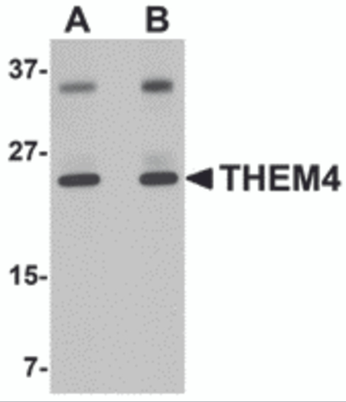 Western blot analysis of THEM4 in human liver tissue lysate with THEM4 antibody at (A) 1 and (B) 2 &#956;g/mL.