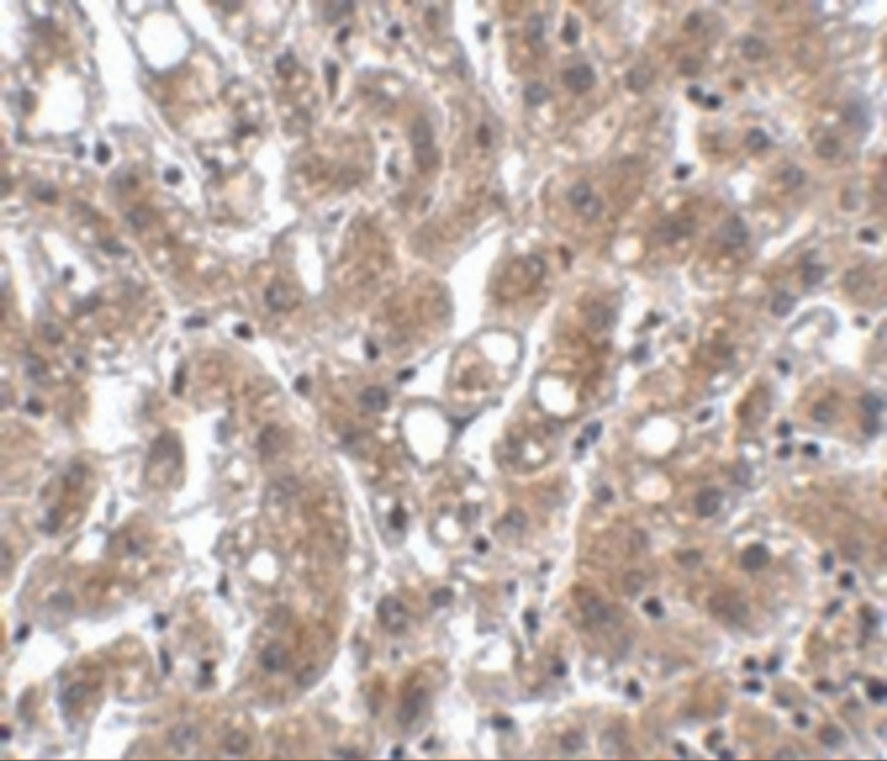 Immunohistochemistry of THEM4 in human liver tissue with THEM4 antibody at 2.5 ug/mL.