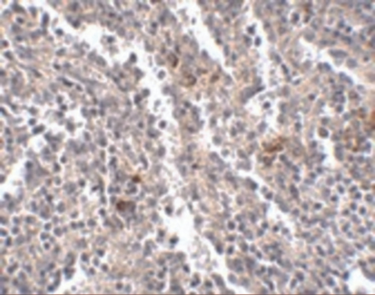 Immunohistochemistry of SYPL2 in human spleen tissue with SYPL2 antibody at 2.5 ug/mL.