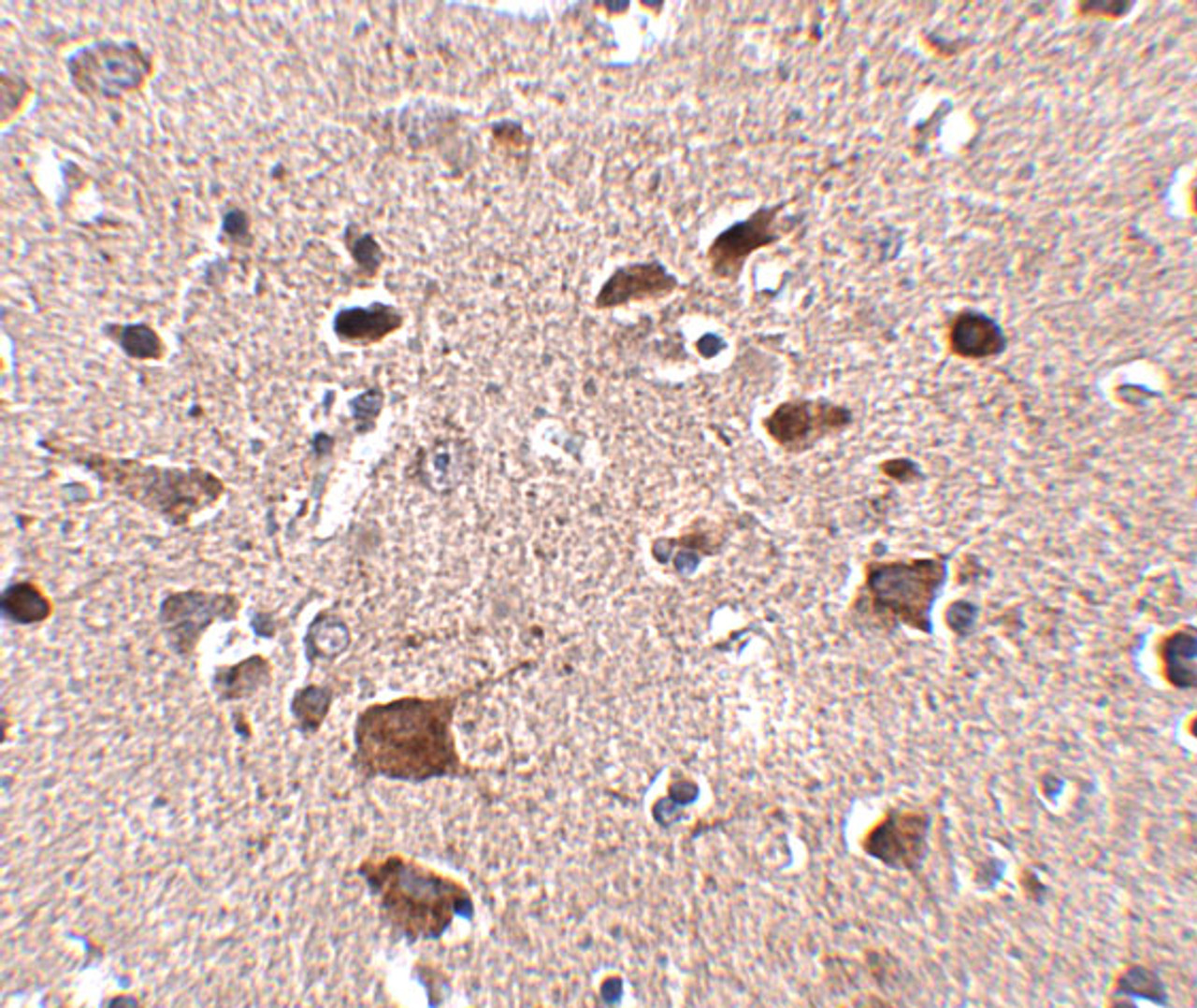 Immunohistochemistry of CCDC134 in human brain tissue with CCDC134 antibody at 2.5 ug/mL.