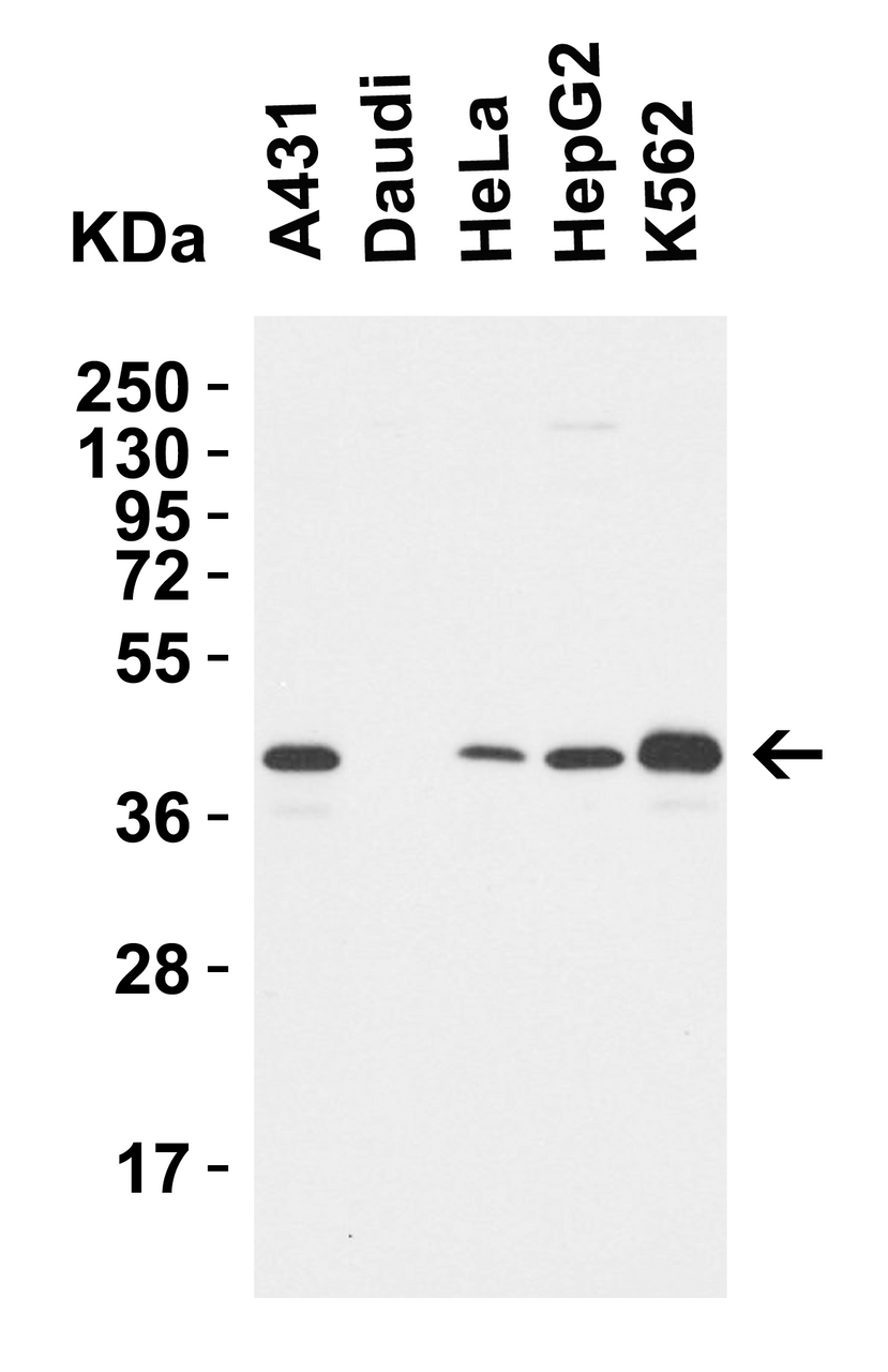 Figure 2 Western Blot Validation in Human Cell Lines
Loading: 15 ug of lysates per lane.
Antibodies: MPYS 5269 (1 ug/mL) , 1h incubation at RT in 5% NFDM/TBST.
Secondary: Goat anti-rabbit IgG HRP conjugate at 1:10000 dilution.