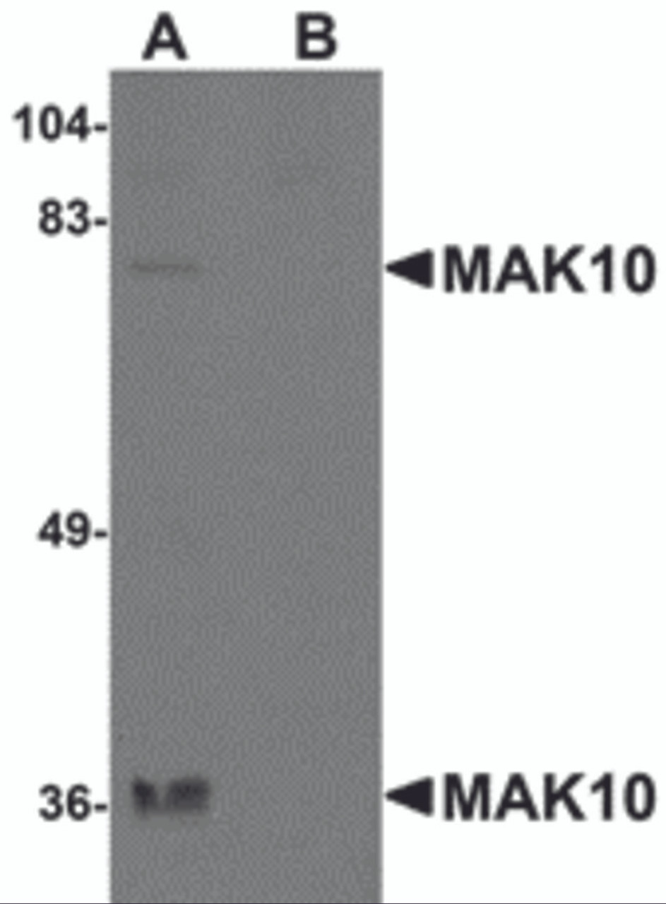 Western blot analysis of MAK10 in rat heart tissue lysate with MAK10 antibody at 1 &#956;g/mL in the (A) absence and (B) presence of blocking peptide.