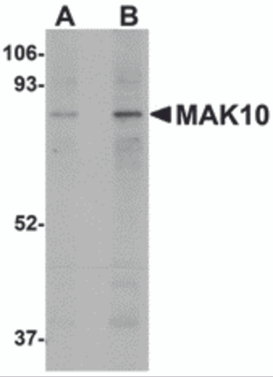 Western blot analysis of MAK10 in mouse heart tissue lysate with MAK10 antibody at (A) 1 and (B) 2 &#956;g/mL.