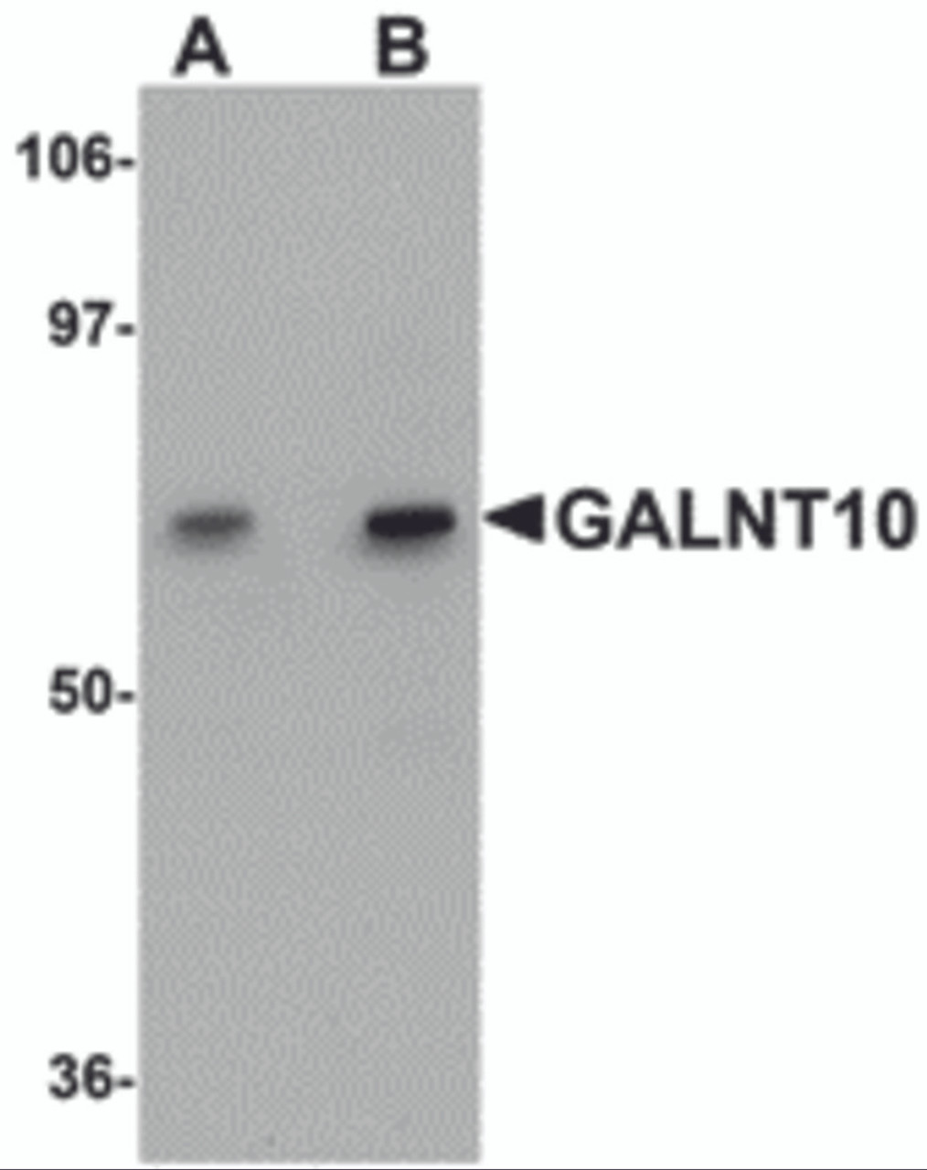 Western blot analysis of GALNT10 in SK-N-SH cell lysate with GALNT10 antibody at (A) 1 and (B) 2 &#956;g/mL.