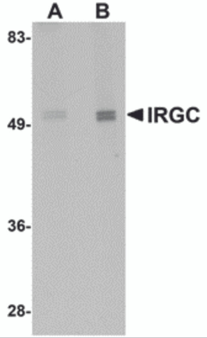 Western blot analysis of IRGC in mouse brain tissue lysate with IRGC antibody at (A) 1 and (B) 2 &#956;g/mL.