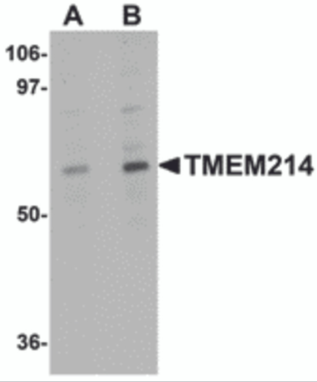 Western blot analysis of TMEM214 in A20 cell lysate with TMEM214 antibody at (A) 1 and (B) 2 &#956;g/mL.