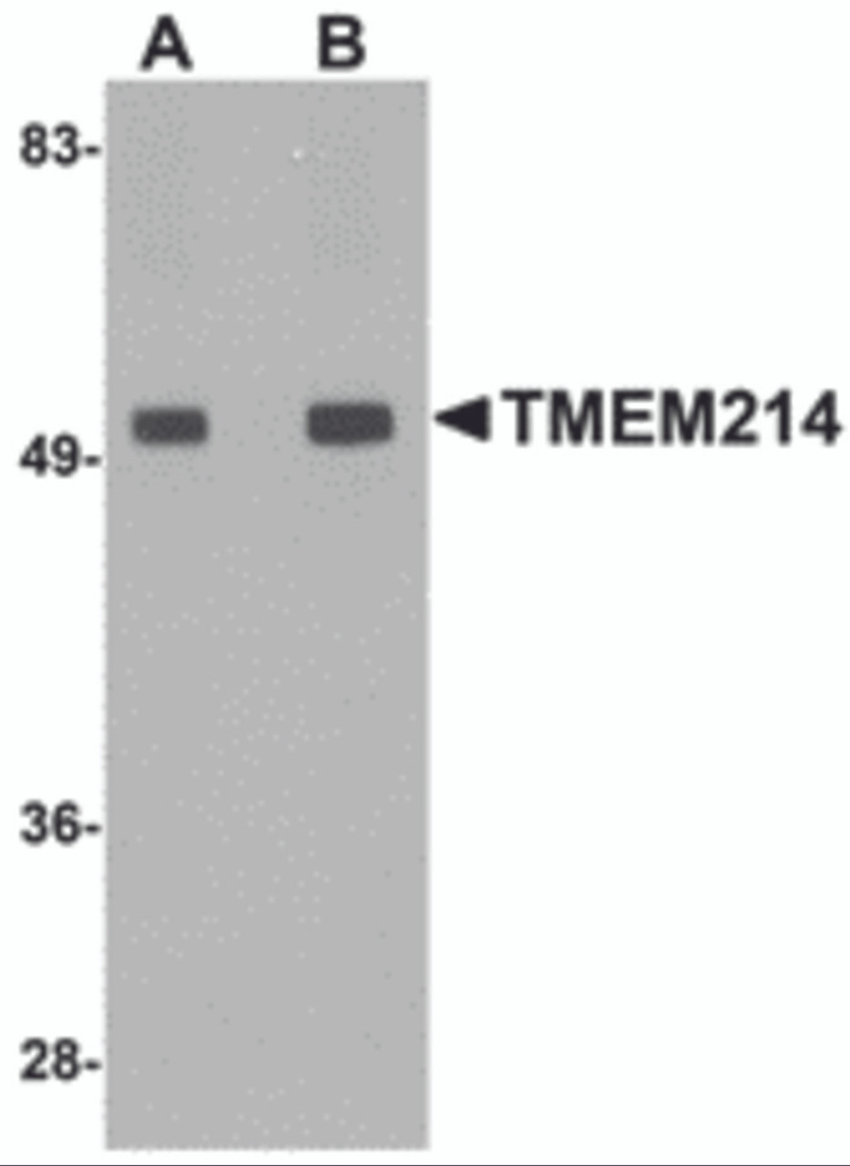 Western blot analysis of TMEM214 in rat brain tissue lysate with TMEM214 antibody at (A) 1 and (B) 2 &#956;g/mL.