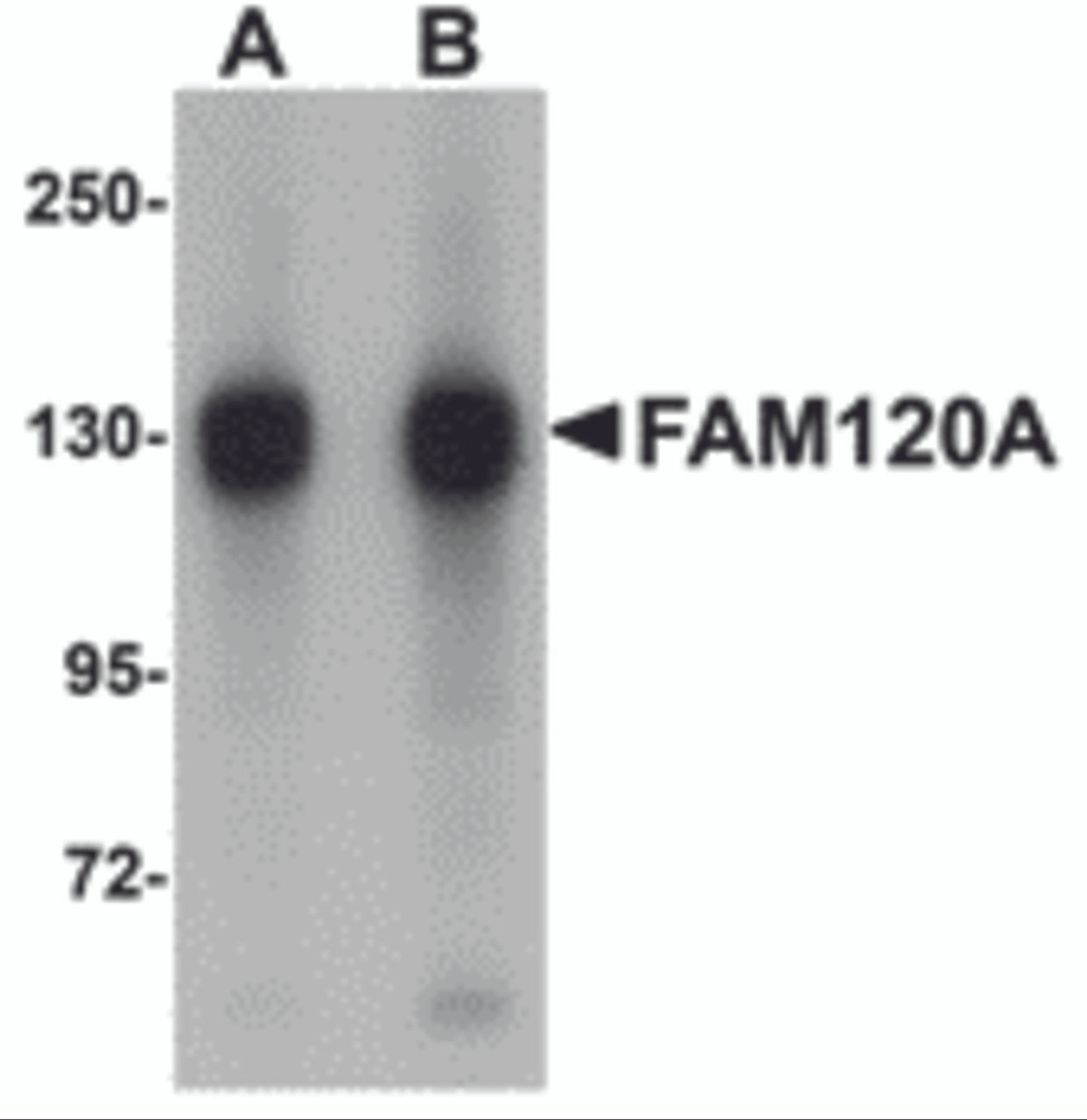 Western blot analysis of FAM120A in SK-N-SH cell lysate with FAM120A antibody at (A) 0.5 and (B) 1 &#956;g/mL.