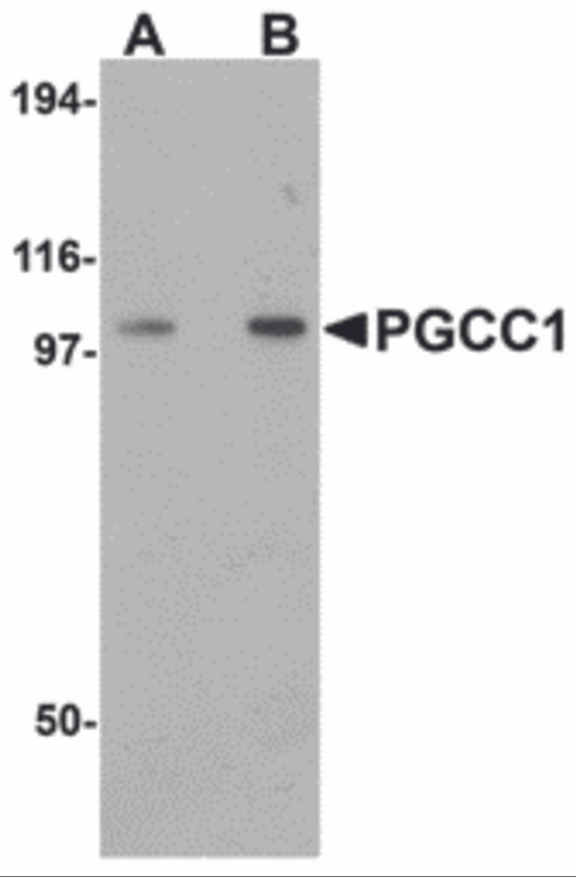 Western blot analysis of PGCC1 in rat thymus tissue lysate with PGCC1 antibody at (A) 0.5 and (B) 1 &#956;g/mL.