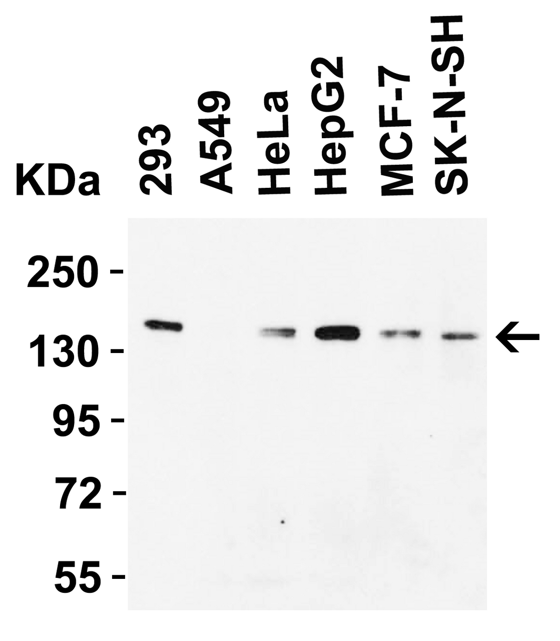 Figure 1 Western Blot Validation in Human Cell Lines
Loading: 15 &#956;g of lysates per lane.
Antibodies: JMJD1A, 5365 (2 &#956;g/mL) , 1h incubation at RT in 5% NFDM/TBST.
Secondary: Goat anti-rabbit IgG HRP conjugate at 1:10000 dilution.