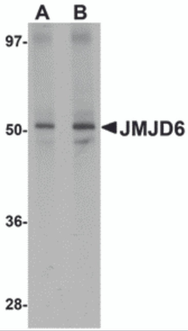 Western blot analysis of JMJD6 in human brain tissue lysate with JMJD6 antibody at (A) 1 and (B) 2 &#956;g/mL.