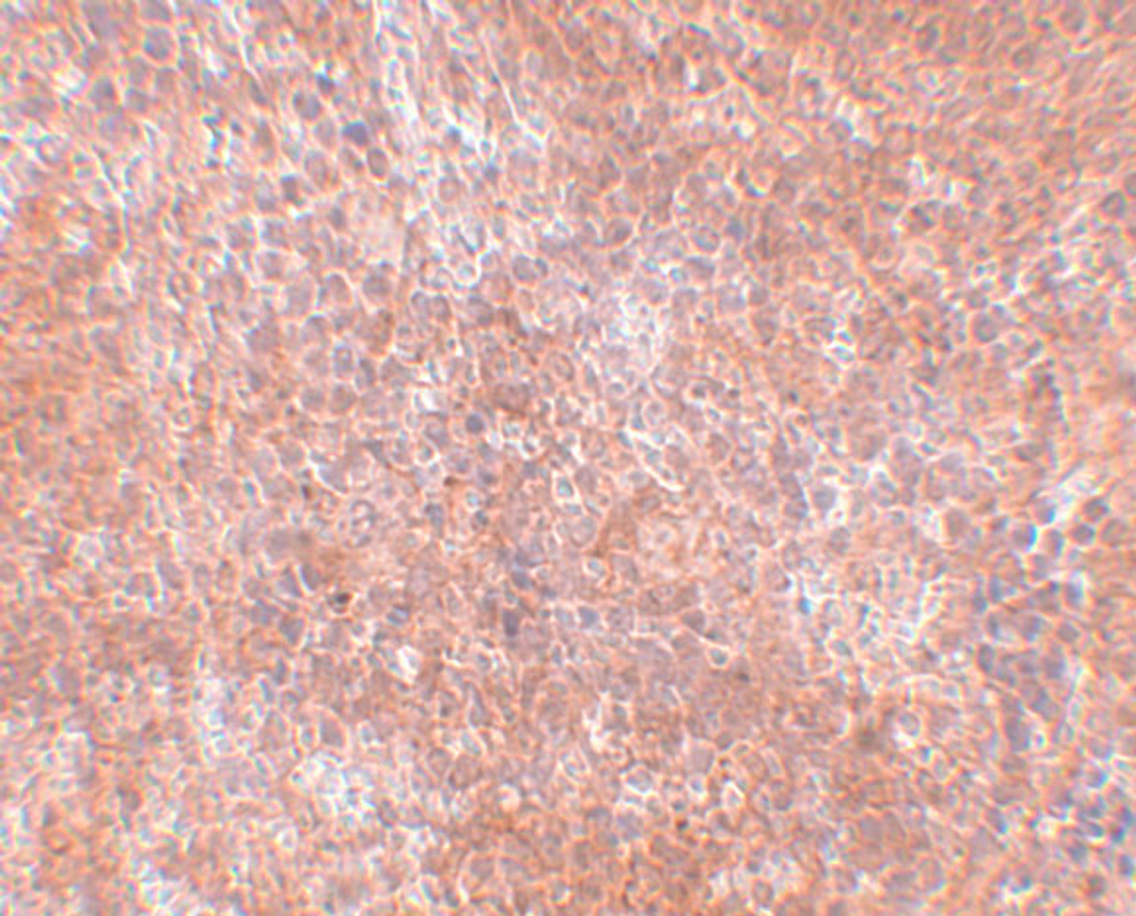 Immunohistochemistry of JMJD8 in mouse spleen tissue with JMJD8 antibody at 2.5 ug/mL.