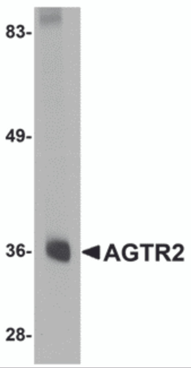 Western blot analysis of AGTR2 in mouse liver tissue lysate with AGTR2 antibody at 0.5 &#956;g/mL.