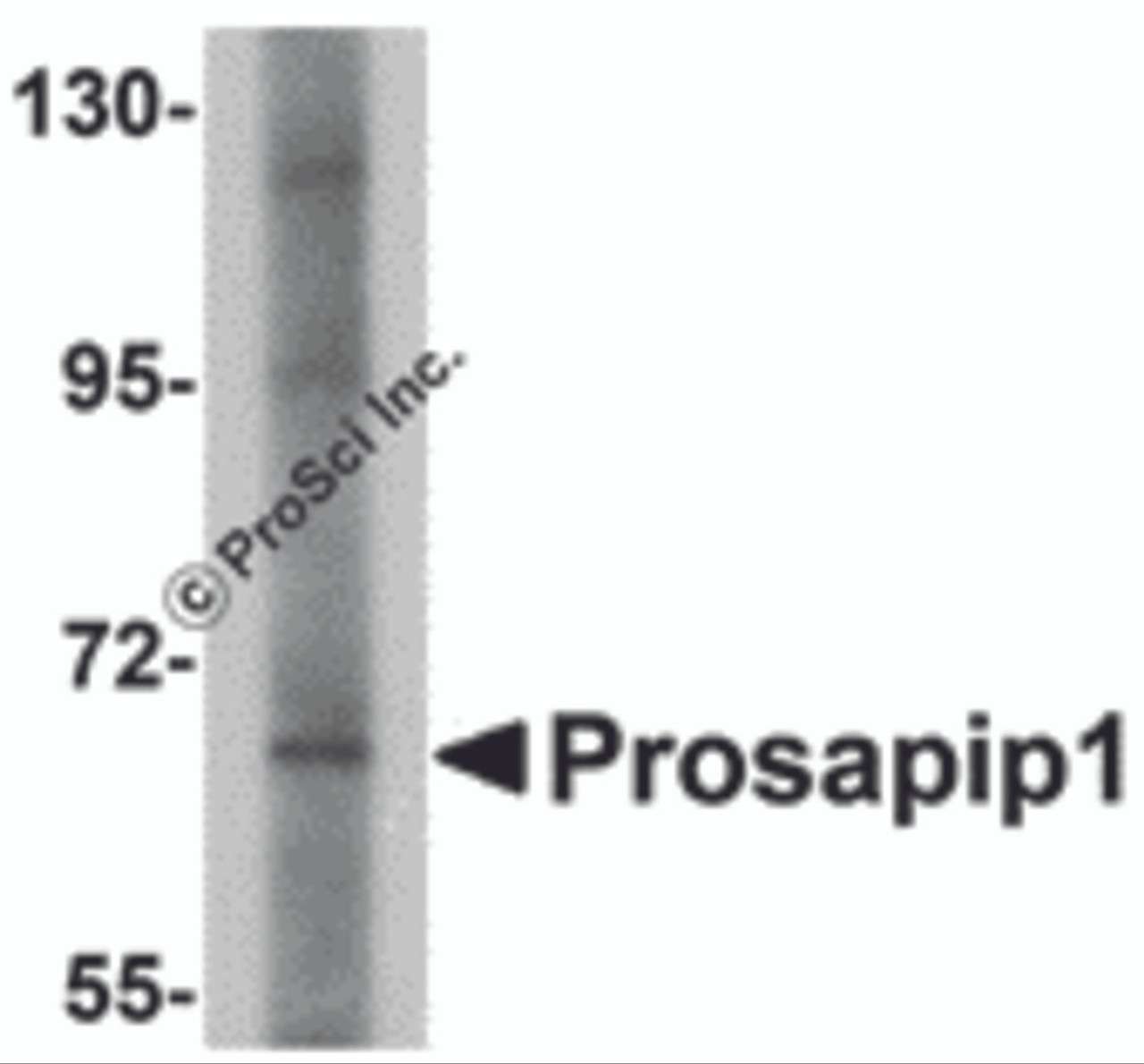 Western blot analysis of Prosapip1 in SK-N-SH cell lysate with Prosapip1 antibody at 1 &#956;g/mL.