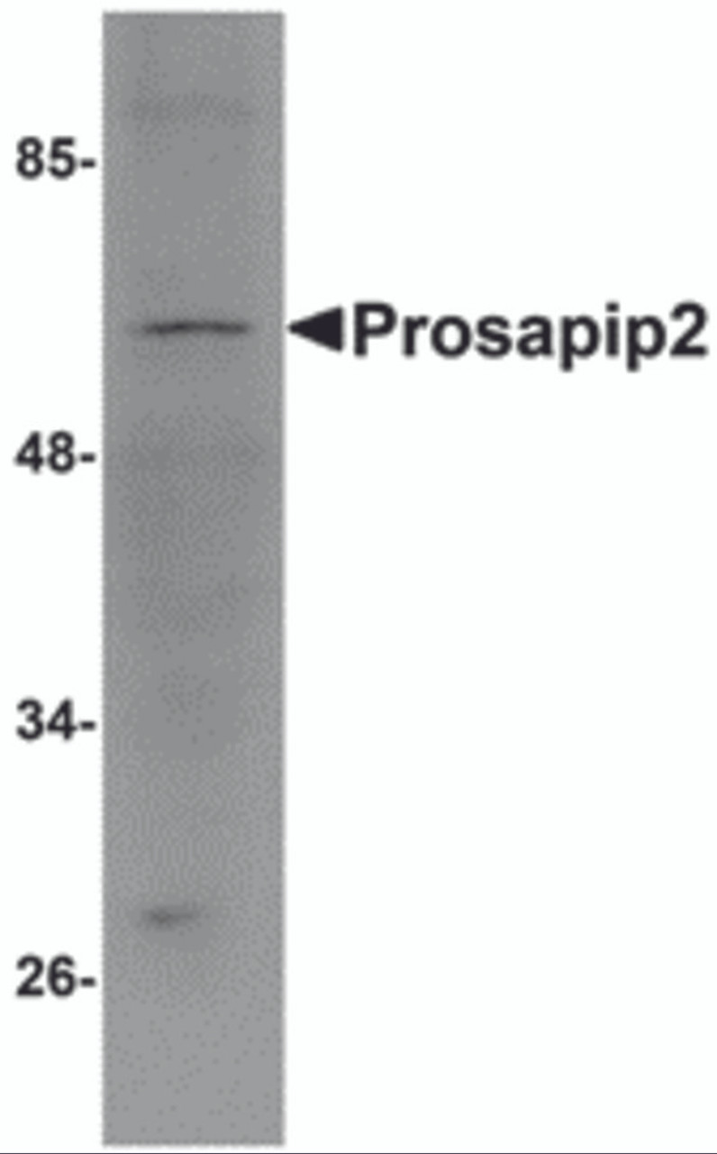 Western blot analysis of Prosapip2 in rat liver tissue lysate with Prosapip2 antibody at 1 &#956;g/mL.