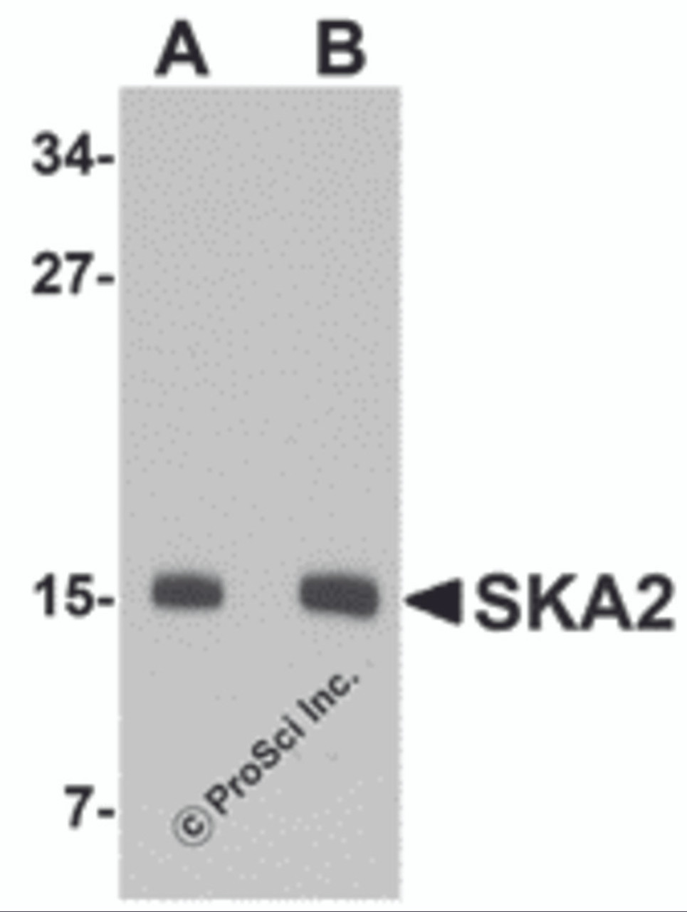 Western blot analysis of SKA2 in 3T3 cell lysate with SKA2 antibody at (A) 0.5 and (B) 1 &#956;g/mL.