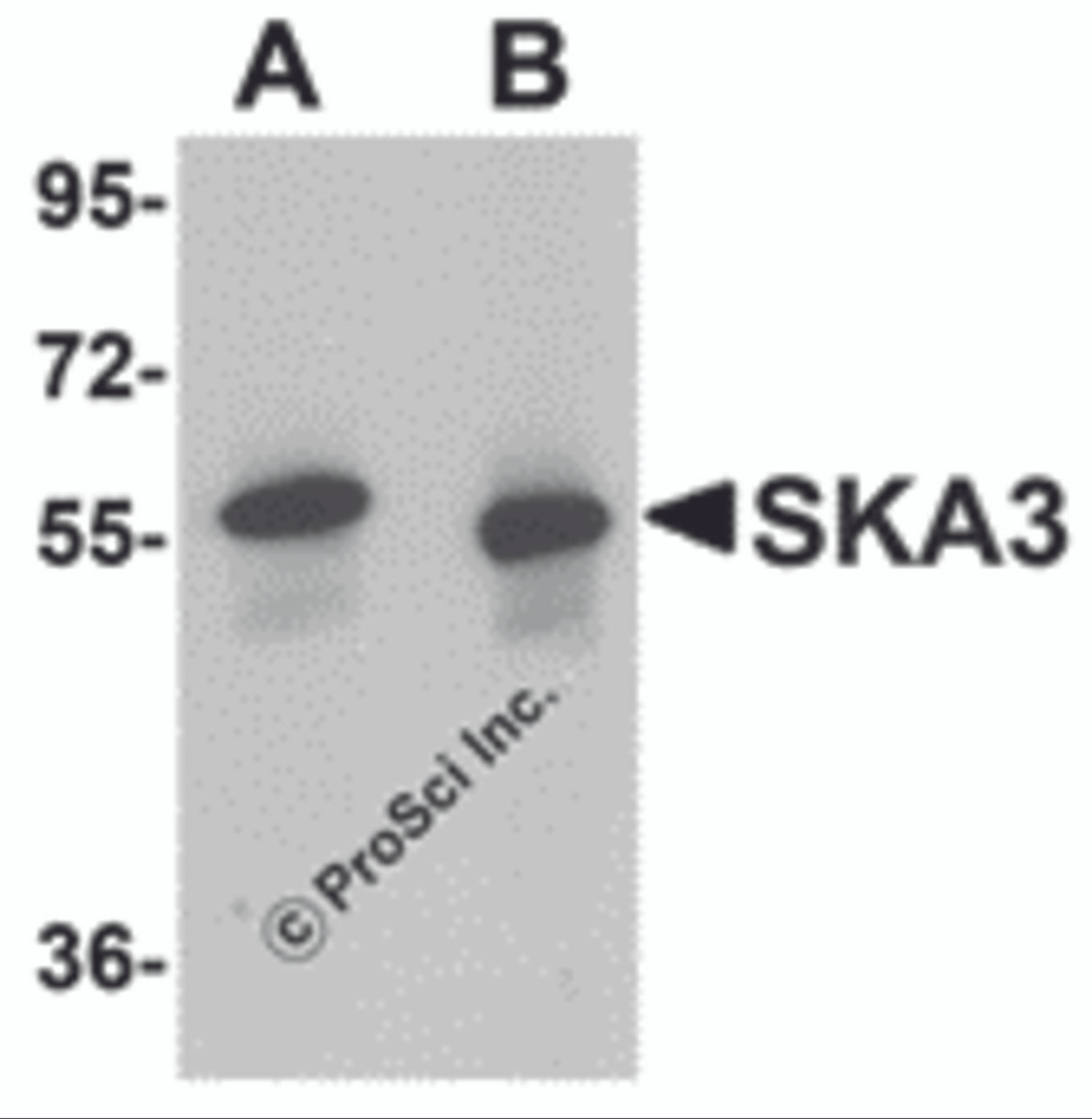Western blot analysis of SKA3 in human testis tissue lysate with SKA3 antibody at (A) 0.5 and (B) 1 &#956;g/mL.