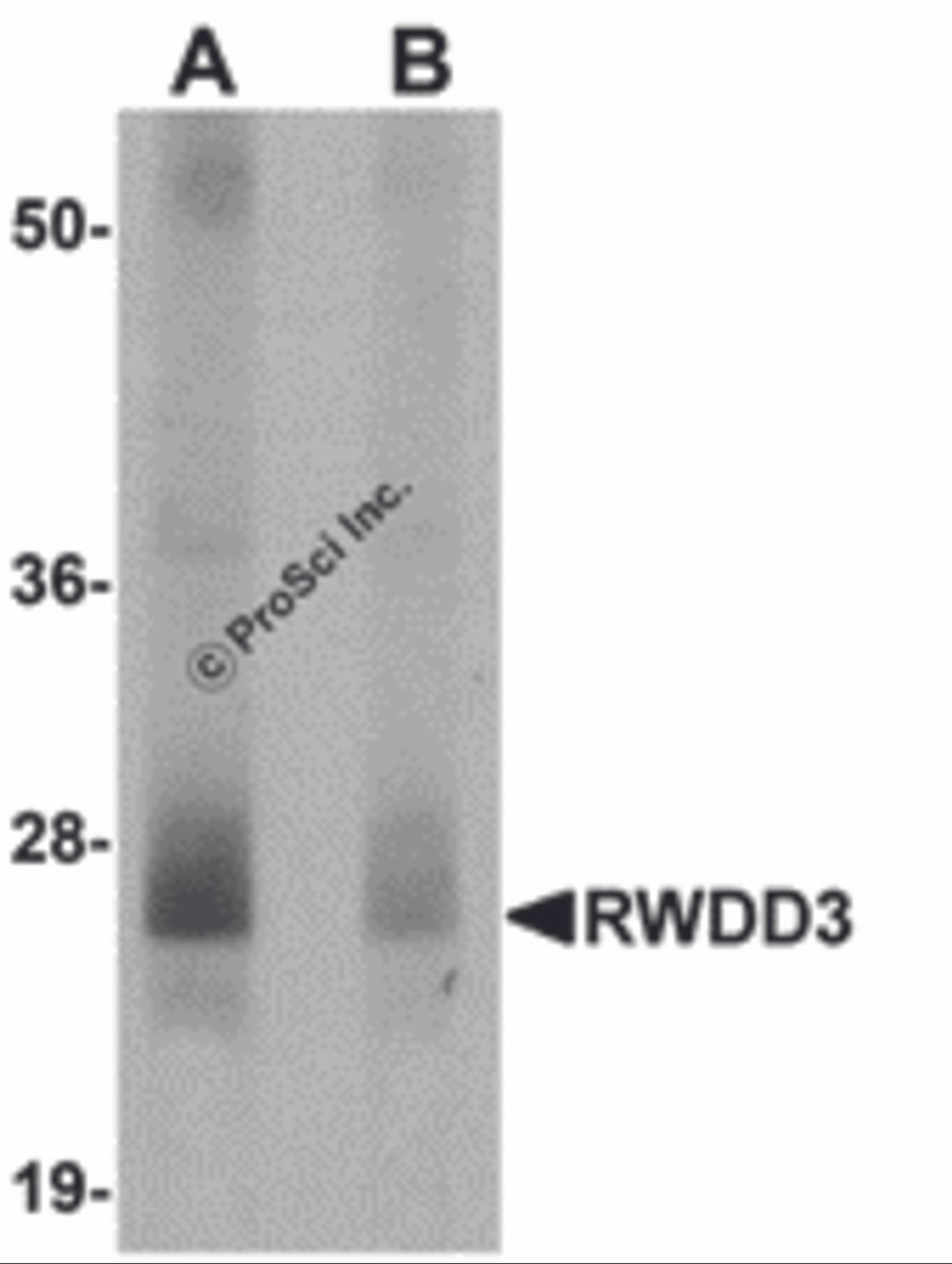 Western blot analysis of RWDD3 in mouse kidney tissue lysate with RWDD3 antibody at 0.5 &#956;g/mL in (A) the absence and (B) the presence of blocking peptide.