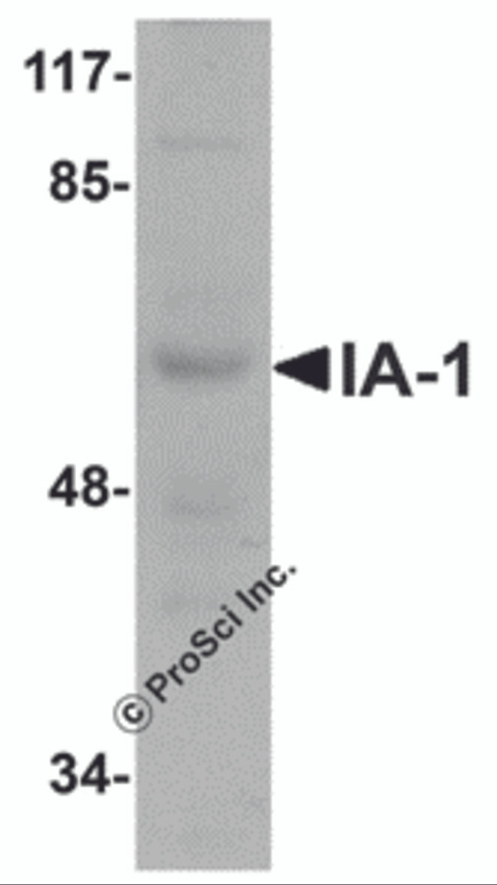 Western blot analysis of IA-1 in rat thymus tissue lysate with IA-1 antibody at 1 &#956;g/mL.