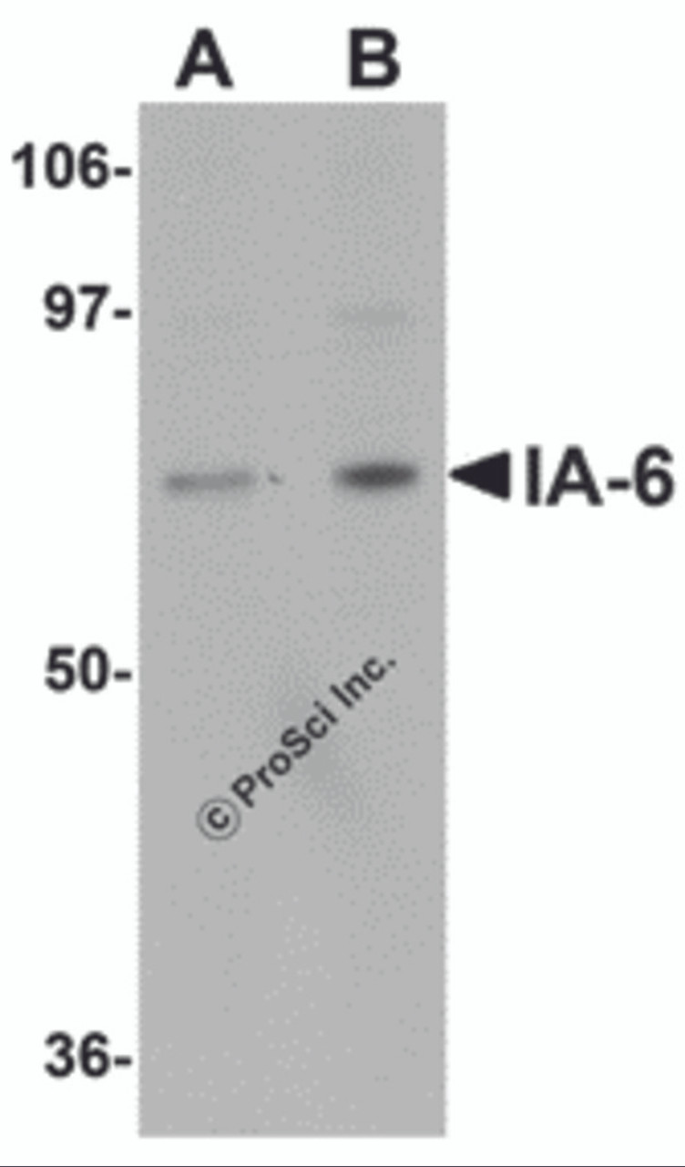 Western blot analysis of IA-6 in rat thymus tissue lysate with IA-6 antibody at (A) 1 and (B) 2 &#956;g/mL.