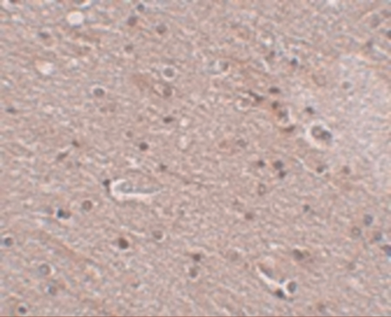 Immunohistochemistry of TMEM16B in human brain tissue with FRMPD4 antibody at 5 ug/mL.