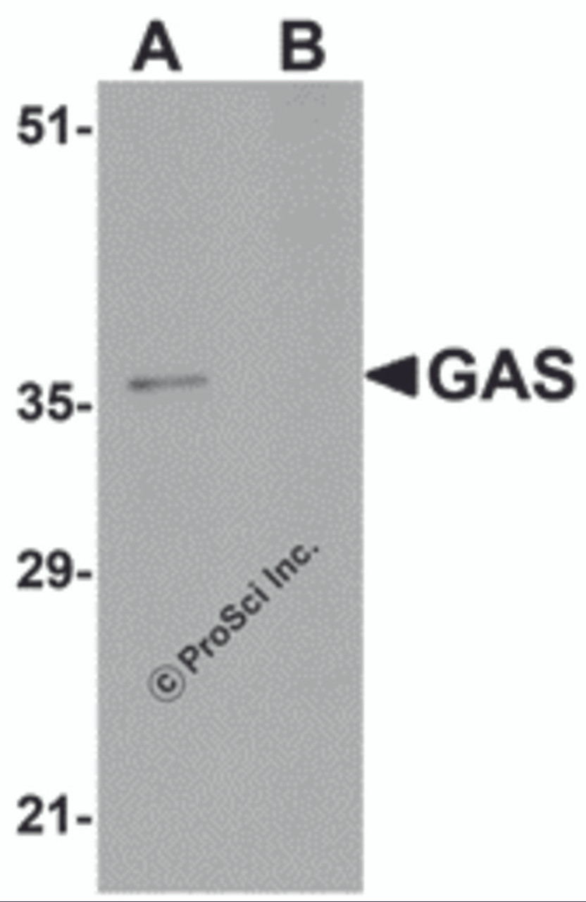 Western blot analysis of GAS in EL4 cell lysate in (A) the absence and (B) the presence of blocking peptide with GAS antibody at 1&#956;g/mL.