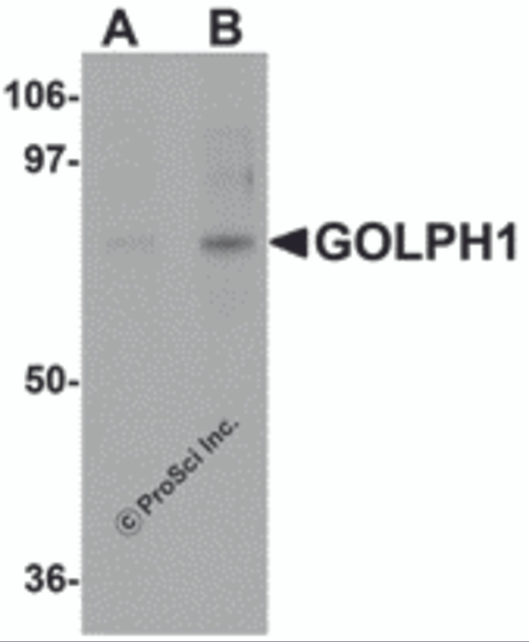 Western blot analysis of GOLPH1 in K562 cell lysate with GOLPH1 antibody at (A) 1 and (B) 2 &#956;g/mL.