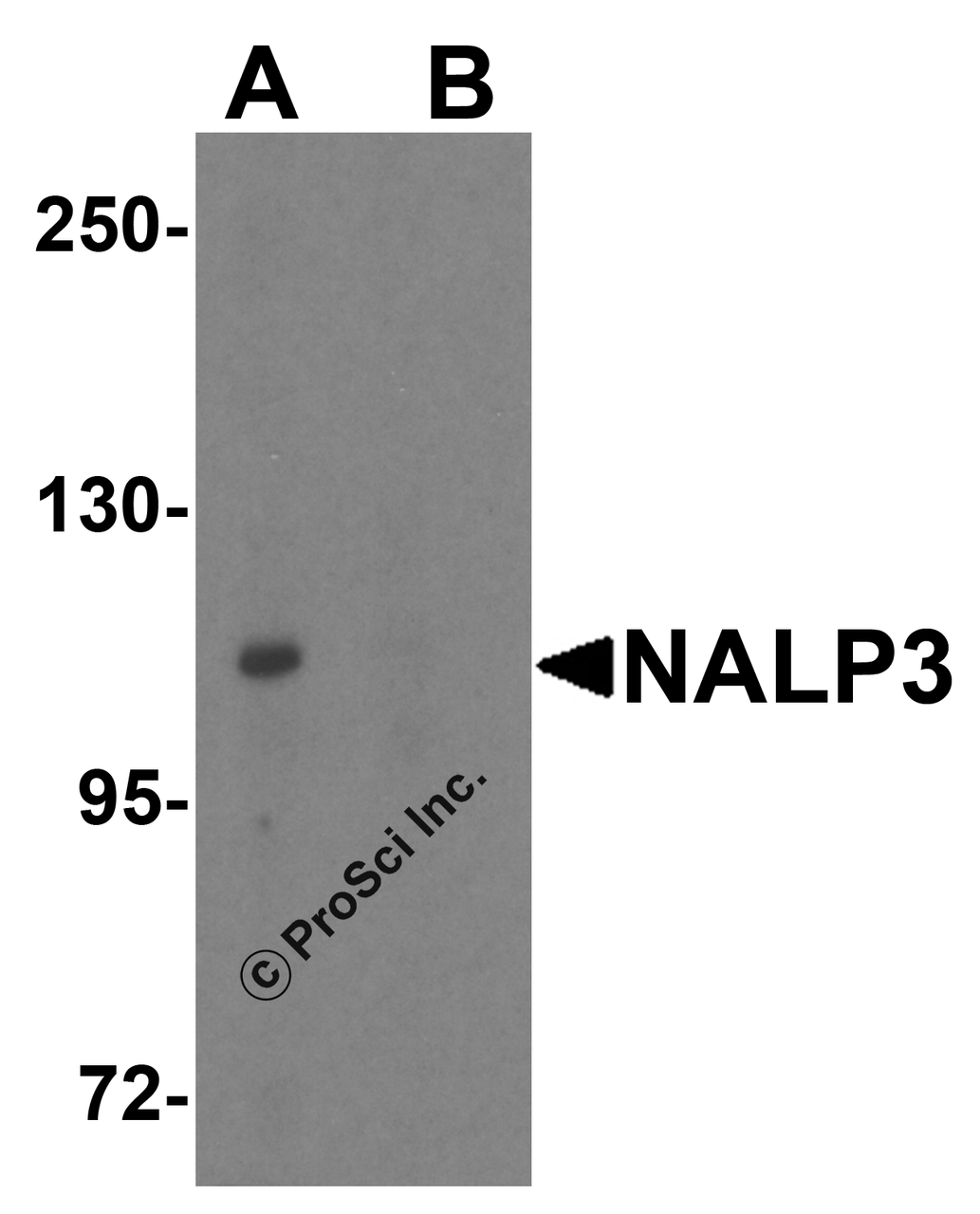 Western blot analysis of NALP3 in K562 cell lysate with NALP3 antibody at 1 &#956;g/mL (A) in the absence and (B) in the presence of blocking peptide.