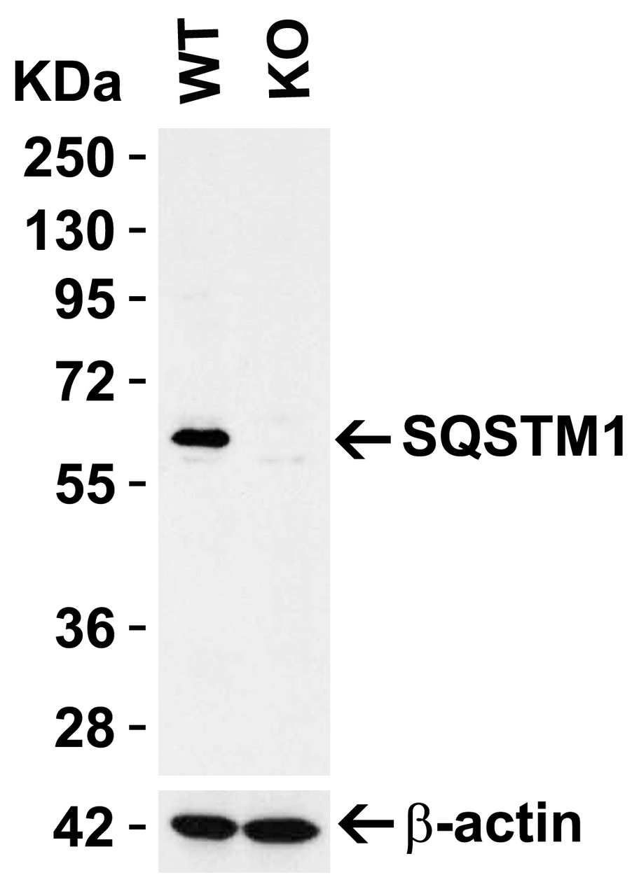 Figure 1 KO Validation in HEK293T Cells 
Loading: 10 &#956;g of HEK293T WT cell lysates or SQSTM1 KO cell lysates. Antibodies: SQSTM1 5449 (1 &#956;g/mL) and beta-actin 3779 (1 &#956;g/mL) , 1 h incubation at RT in 5% NFDM/TBST.
Secondary: Goat Anti-Rabbit IgG HRP conjugate at 1:10000 dilution.