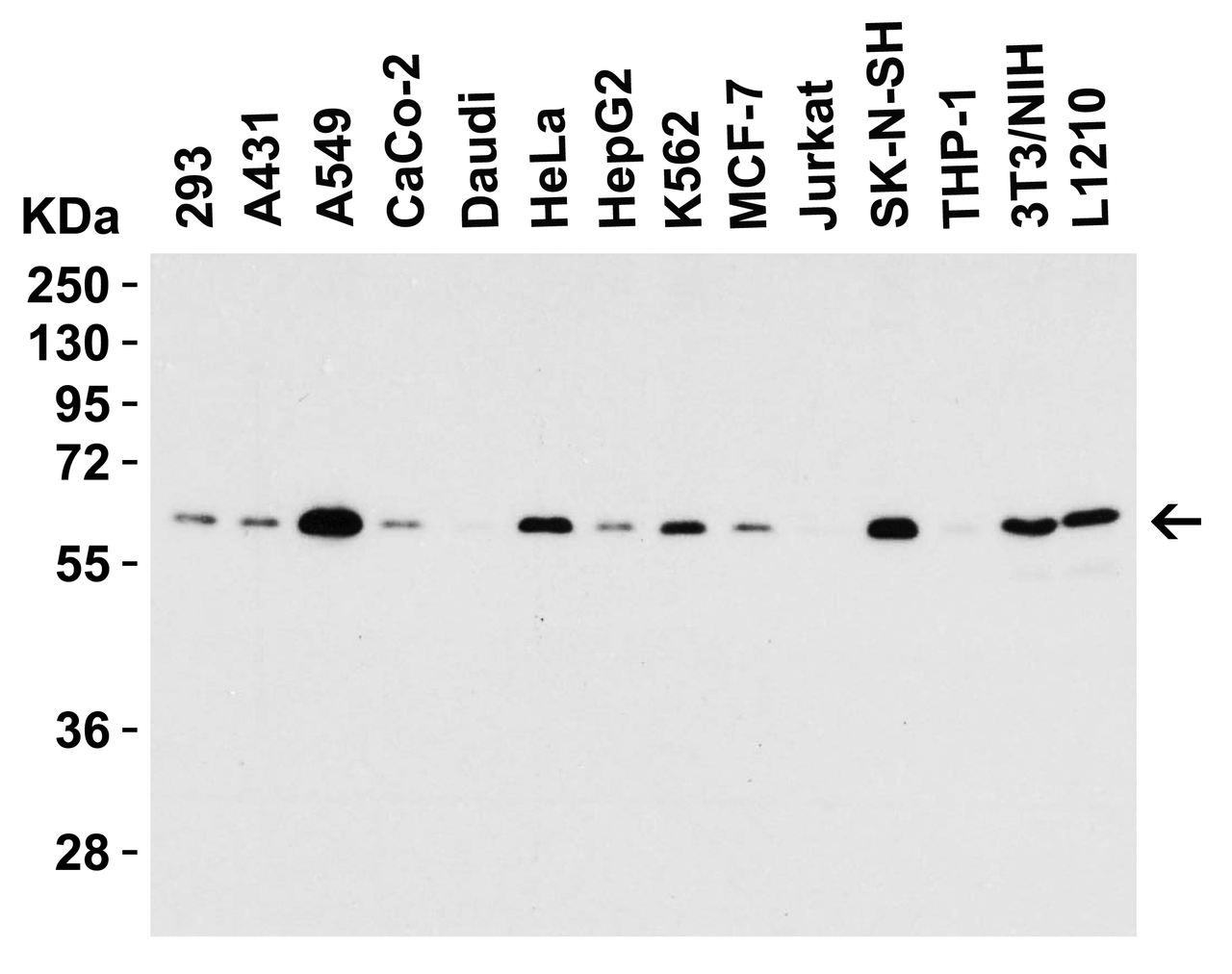 Figure 2 Western Blot Validation in Cell Lines
Loading: 15 µg of lysates per lane.
Antibodies: SQSTM1 5449 (0.5 ug/mL) , 1h incubation at RT in 5% NFDM/TBST.
Secondary: Goat anti-rabbit IgG HRP conjugate at 1:10000 dilution.