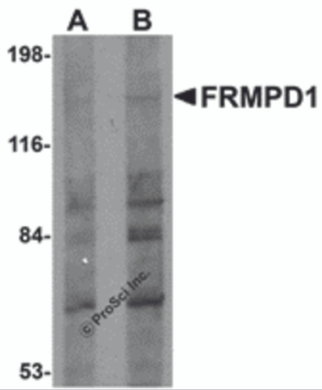 Western blot analysis of FRMPD1 in K562 cell lysate with FRMPD1 antibody at (A) 1 and (B) 2 &#956;g/mL.