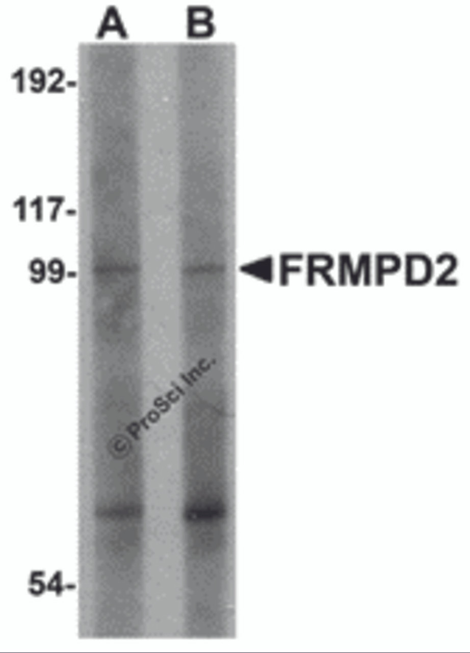 Western blot analysis of FRMPD2 in rat kidney tissue lysate with FRMPD2 antibody at (A) 1 and (B) 2 &#956;g/mL.