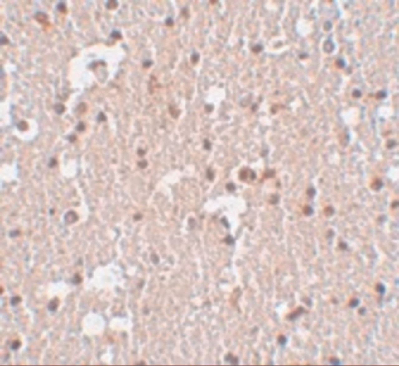Immunohistochemistry of FRMPD3 in human brain tissue with FRMPD3 antibody at 5 ug/mL.