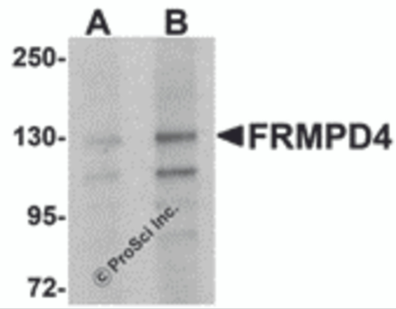 Western blot analysis of FRMPD4 in SK-N-SH cell lysate with FRMPD4 antibody at (A) 1 and (B) 2 &#956;g/mL.