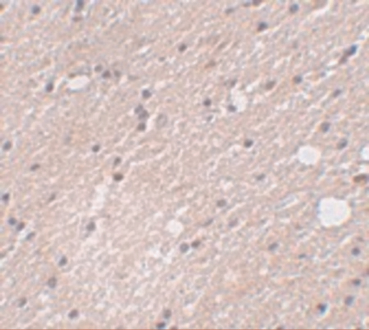 Immunohistochemistry of FRMPD4 in human brain tissue with FRMPD4 antibody at 5 ug/mL.