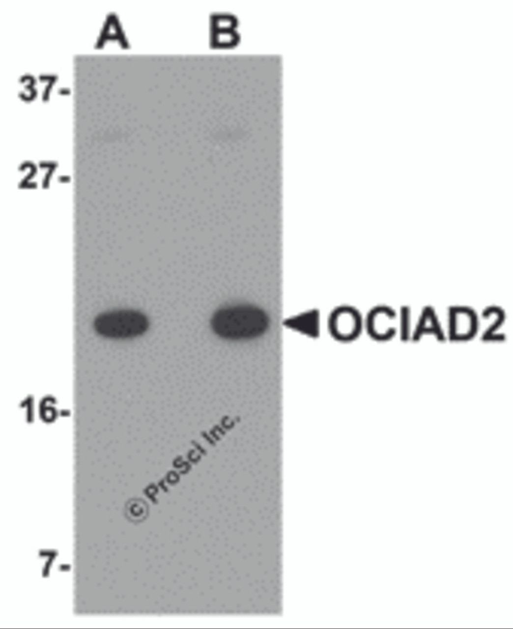 Western blot analysis of OCIAD2 in A549 cell lysate with OCIAD2 antibody at (A) 0.5 and (B) 1 &#956;g/mL.