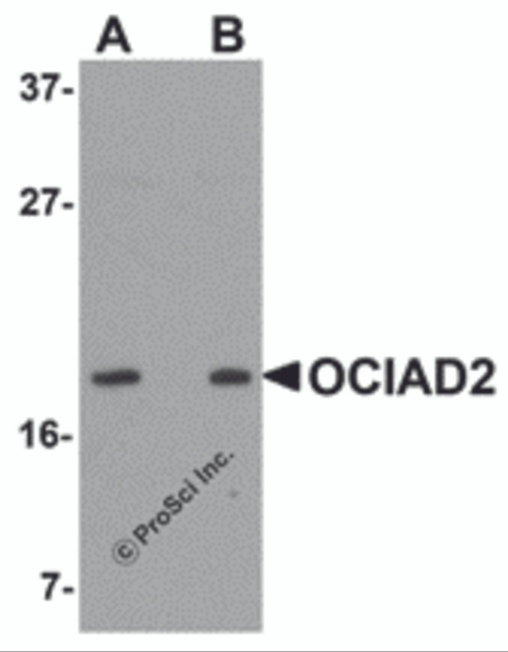 Western blot analysis of OCIAD2 in SK-N-SH cell lysate with OCIAD2 antibody at (A) 0.5 and (B) 1 &#956;g/mL.