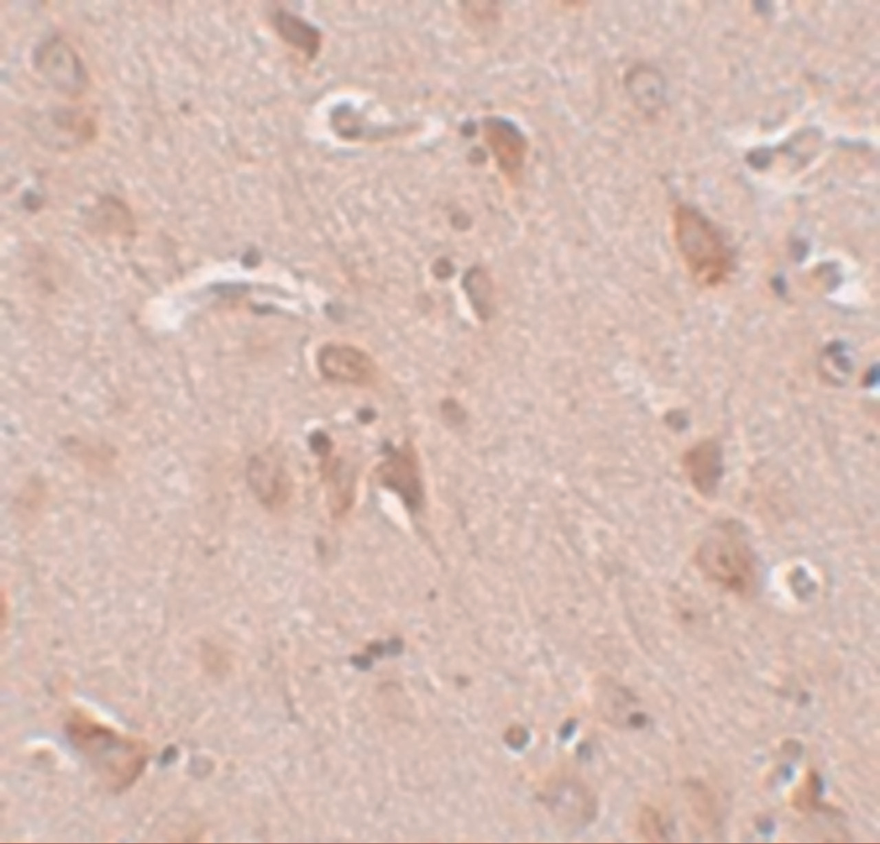 Immunohistochemistry of FAM59B in human brain tissue with FAM59B antibody at 5 ug/mL.
