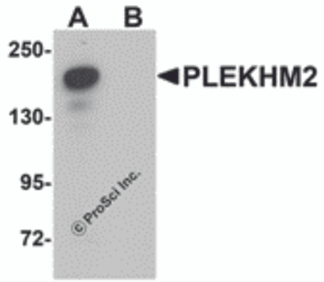 Western blot analysis of PLEKHM2 in rat brain tissue lysate with PLEKHM2 antibody at 0.5 &#956;g/mL in (A) the absence and (B) the presence of blocking peptide.