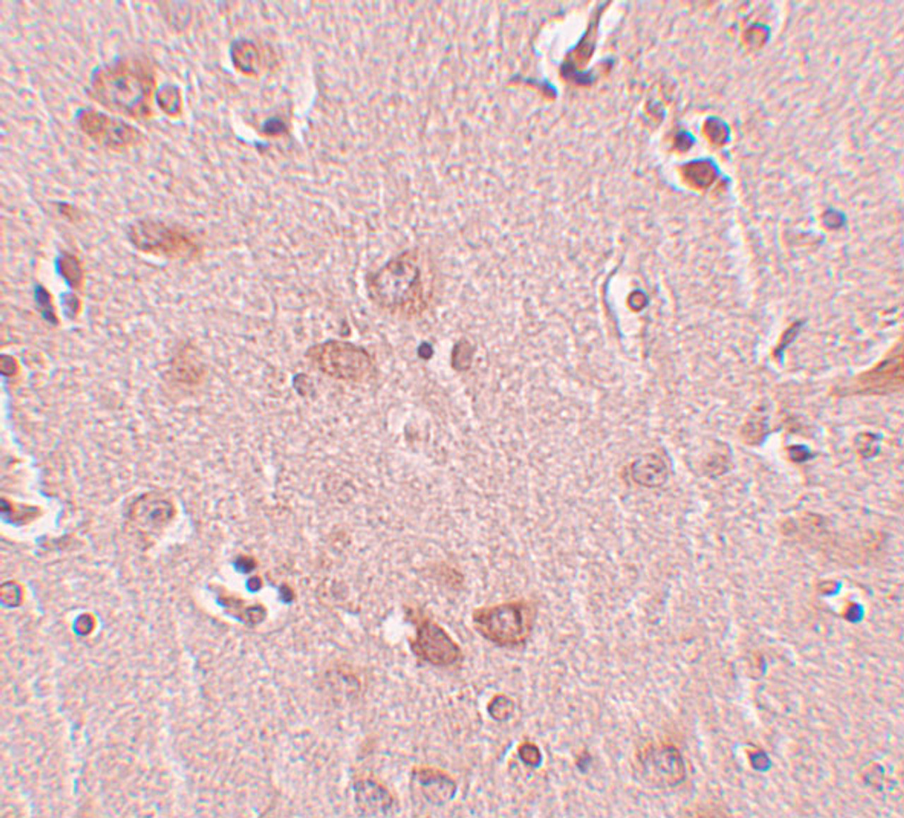 Immunohistochemistry of PLEKHM2 in human liver tissue with FAM59A antibody at 5 ug/mL.