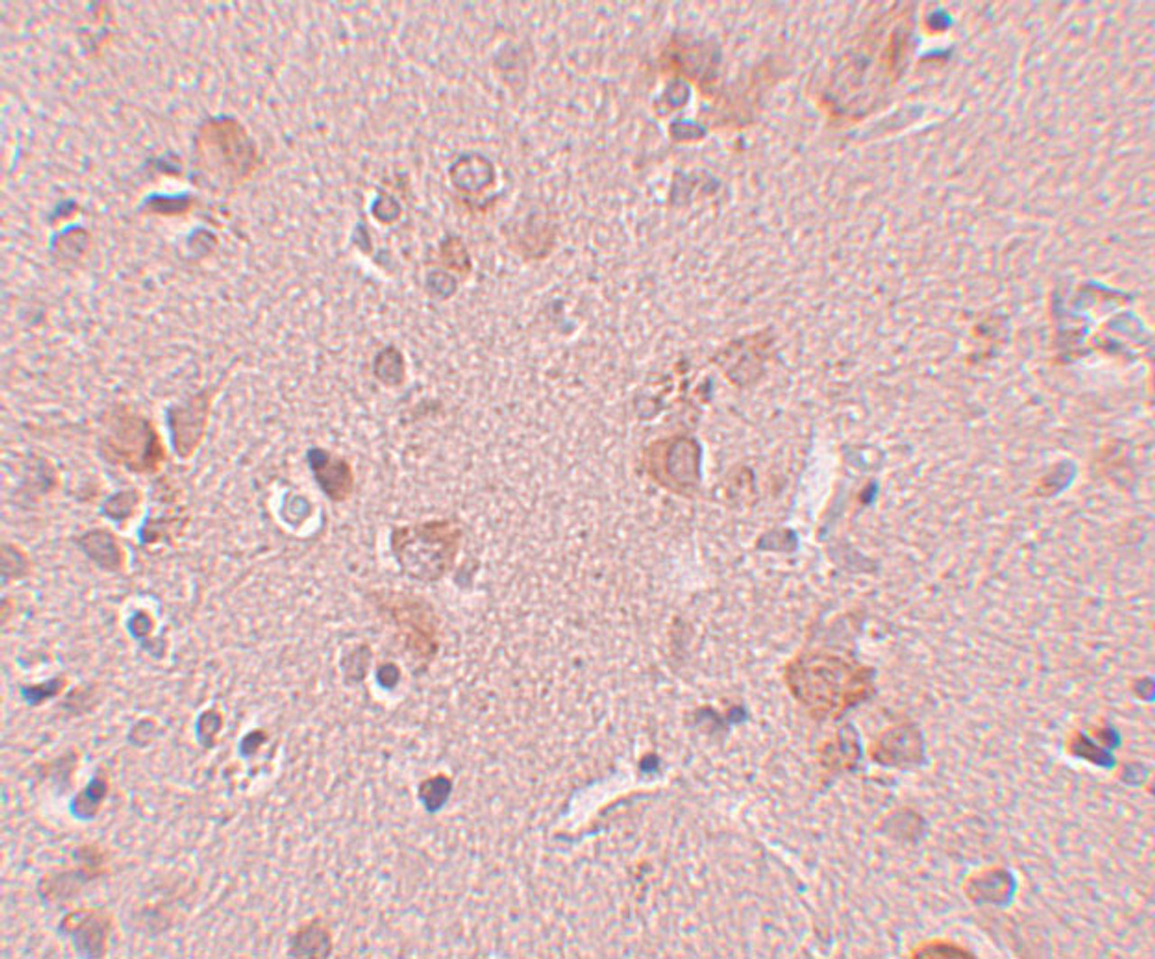 Immunohistochemistry of PLEKHM3 in human brain tissue with PLEKHM3 antibody at 5 ug/mL.